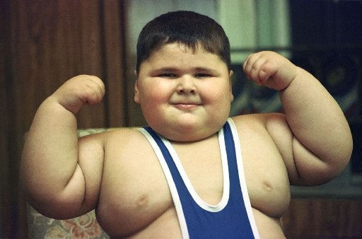 poza despre obezitatea la copii